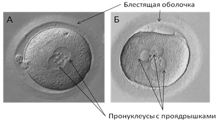 Ооциты первого дня развития in vitro