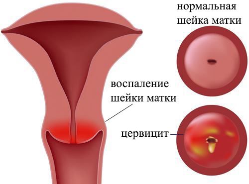 Оплодотворение и период раннего развития эмбриона — статья МЦРМ