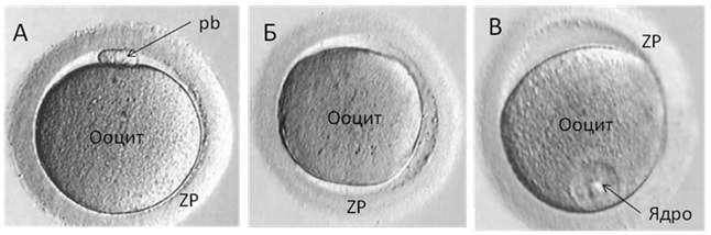 15 день после переноса эмбрионов как выглядит эмбрион фото