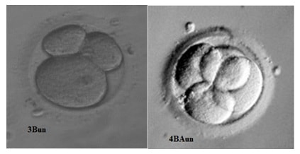 15 день после переноса эмбрионов как выглядит эмбрион фото